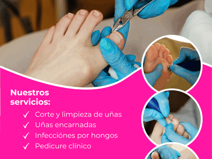 podologia clinica la mejor del cusco recomendado